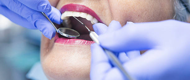 Best Emergency Tooth Extraction in Harlem, FL